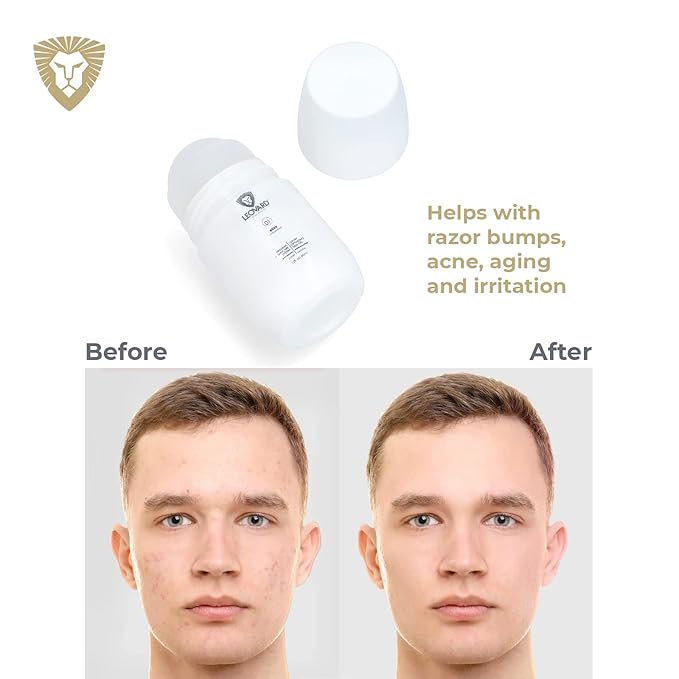 Leovard- Men & Women Razor Bump and Ingrown Hairs Serum - After Your Shave Solution Roll-On for Ingrown Hairs, Razor Bumps, Irritation, Blemishes and Discoloration