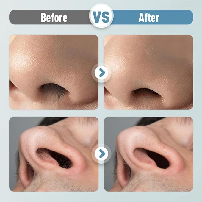 2-in-1 Nose Hair Trimmer, Portable Nostril Hair Remover Tool, 360° Rotating Nose Hair Trimmer with Ear Picker (6 PCS)