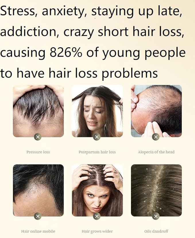 2 Box Ginger Plant Extract Shampoo for Hair Growth and Anti-Loss Control, Hair Growth Oil Care by Ginaday
