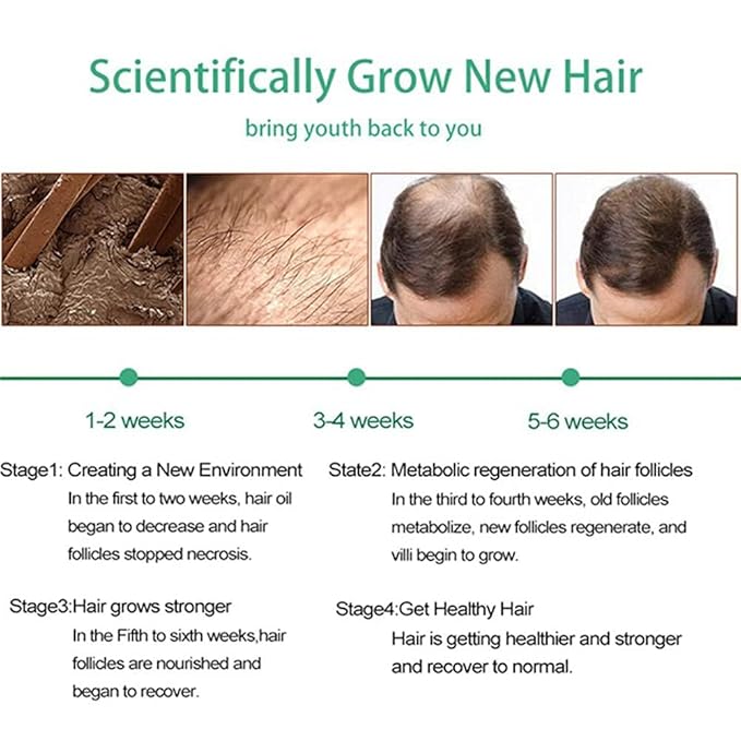 Ginger Hair Growth Serum with Ginger Oil - Anti Hair Loss Treatment, Promotes Thicker, Fuller and Faster Growing Hair (4 FL OZ) (1 Pcs)