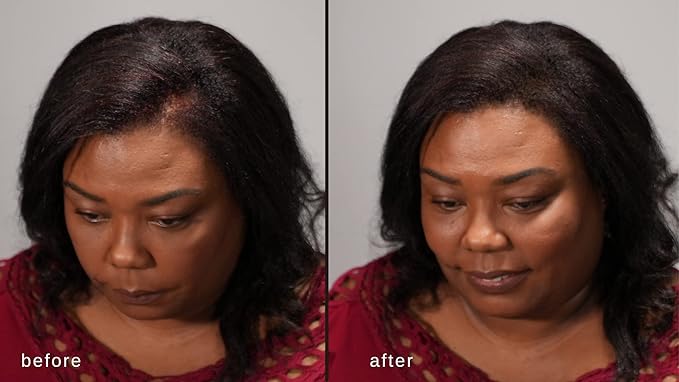 Hair Building Fibers - Volumizing Hair Fibers with real Keratin for Thinning Hair/Hair Loss Dermatologist Tested and Certified Hypoallergenic - 60 days + supply (Medium Brown)