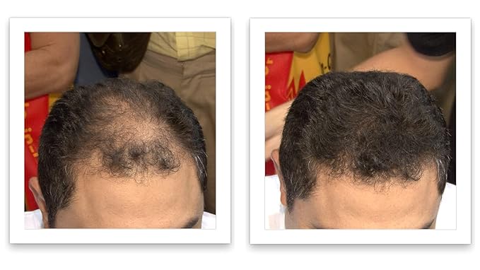 Caboki Hair Fibers for Thinning Hair – Natural Plant-Based Hair Powder for Men & Women – Instantly Thicker Fuller Looking Hair – Wind & Sweat Resistant – 30g, 90-Day Supply, Dark Brown