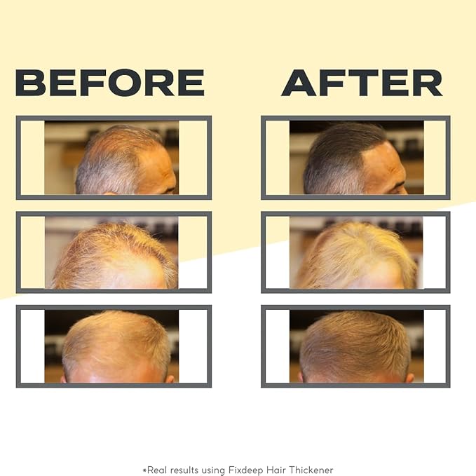 Hair Thickener | New Waterproof Formula - Natural & Fuller Looking Hair in 30 sec - 14g - Fibers for Thinning, Bald Spots & Graying Roots (Dark Brown)