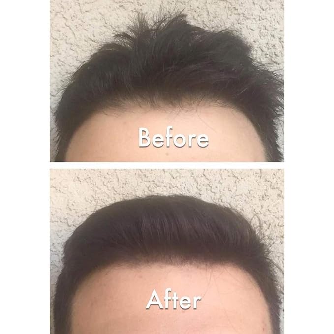 Keratin Hair Building Fibers: Natural Instant Hair Filler and Thickener for Men and Women - Completely Cover Up and Conceal Thinning Areas or Bald Spot - 25 grams