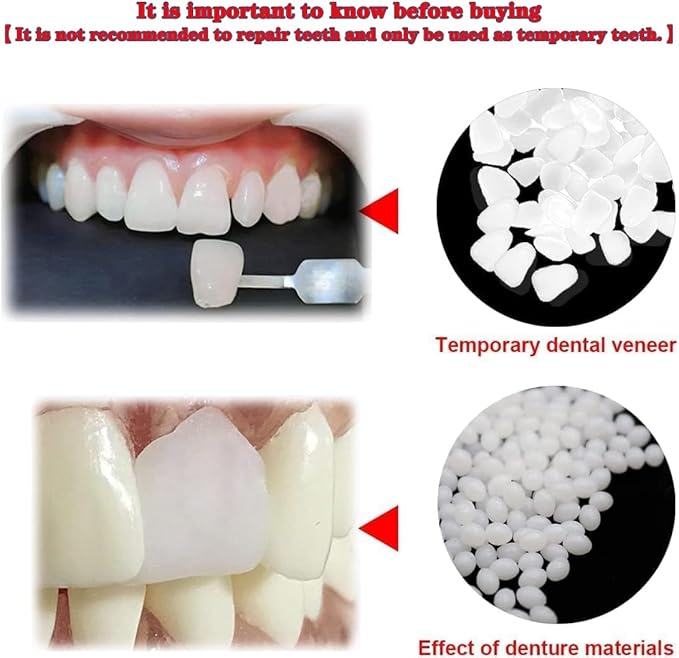 Provisional Tooth Repair Kit-Thermal Fitting Beads Granules and Fake Teeth for Provisional Fixing Missing and Broken Tooth (Teeth - Piece White)