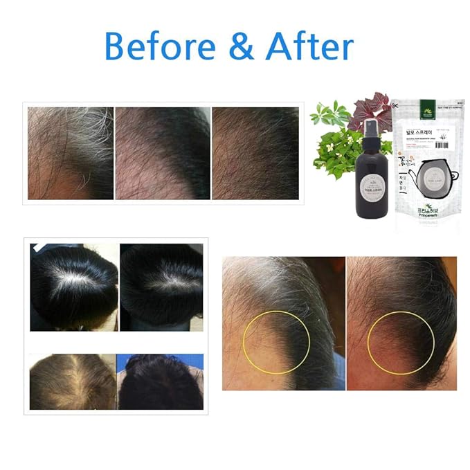 Hair Restoration / 100% Natural Herbal Treatment Spray for helping regrowth of hair/Treatment Spray made from Natural Herbs/발모 스프레이 4oz (118ml)