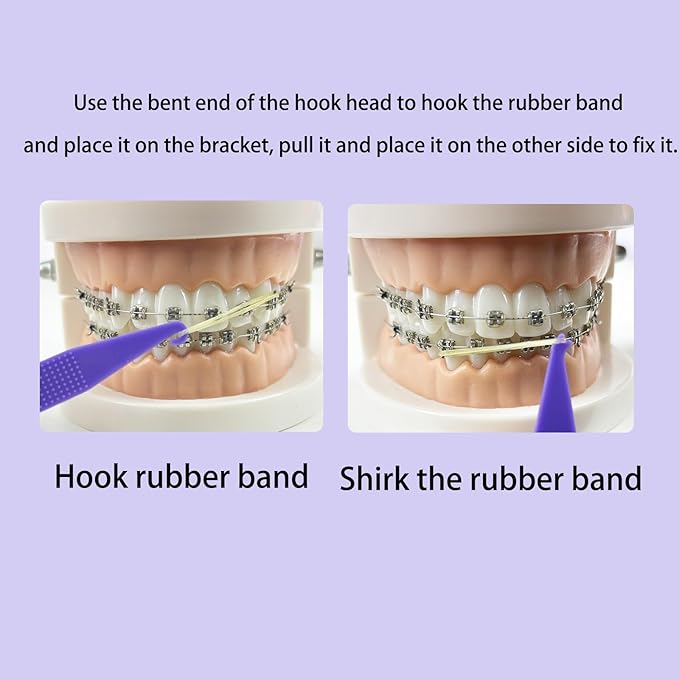 100PCS Elastic Rubber Bands Placers Tool for Braces,Colorful Disposable Plastic Orthodontic Elastic Placers Braces Rubber Band Tool