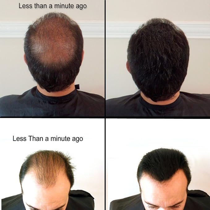 for Thinning Hair - 100% Undetectable Natural Formula - Completely Conceals Hair Loss in Seconds. Covers bald spots. Thicken your hair instantly - 25 Grams Refill (AUBURN)