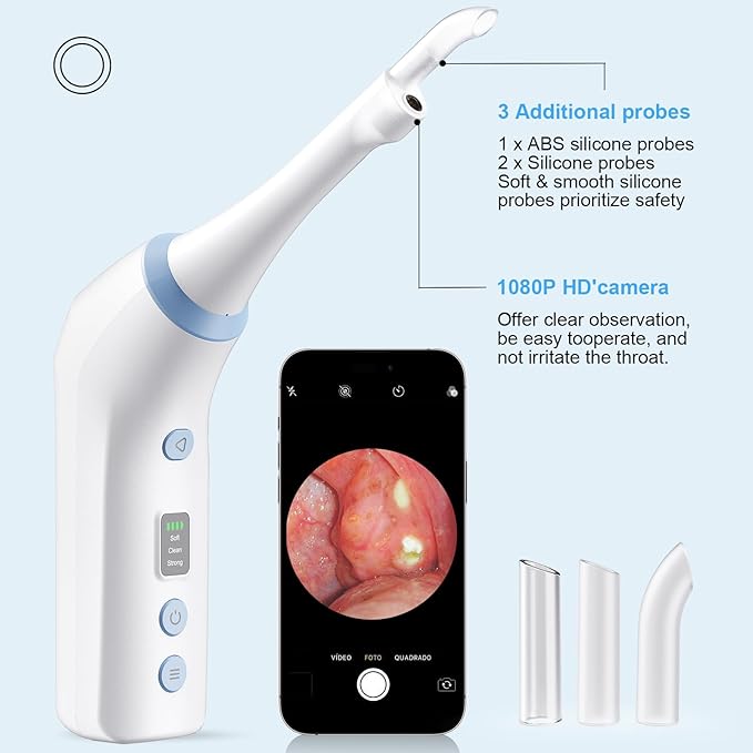 Electronic Tonsil Stone Remover with Camera, Tonsil Stone Removal Kit, 3 Suction Levels, Tonsil Stone Vacuum, Oral Care for Mouth Health, USB Rechargeable