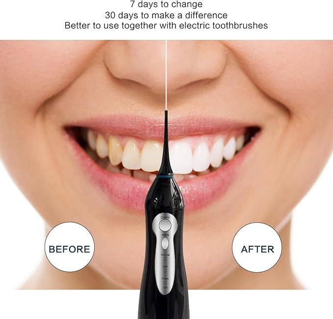 TOVENDOR Electric Water Dental Flosser Teeth Pick, Cordless Flossers Oral Irrigator IPX7 Waterproof 300ML Rechargeable Travel Water Teeth Cleaner with 5 Tips for Home Braces Care Gums Deep Cleaning