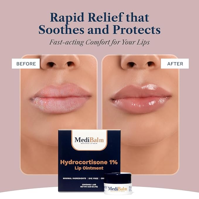 for Dry Cracked Lips - Healing Lip Balm for Severely Chapped Lips - Designed for Men, Women, and Children by Pharmacists 3 Pack