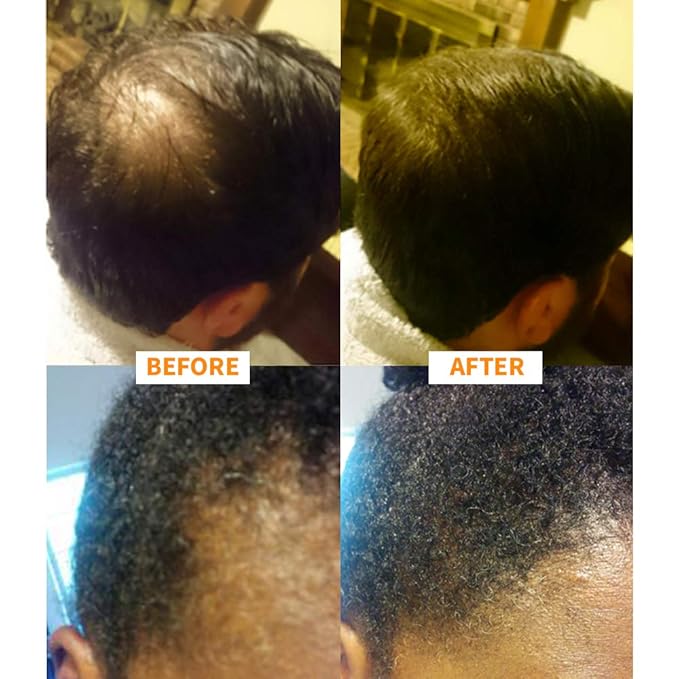 Keratin Hair Building Fibers: Hair Fiber Filler and Thickener for Men and Women - Cover Up and Concealer for Thinning Areas or Minor Bald Spot - Thicker, Fuller Hair in Seconds - 25 grams