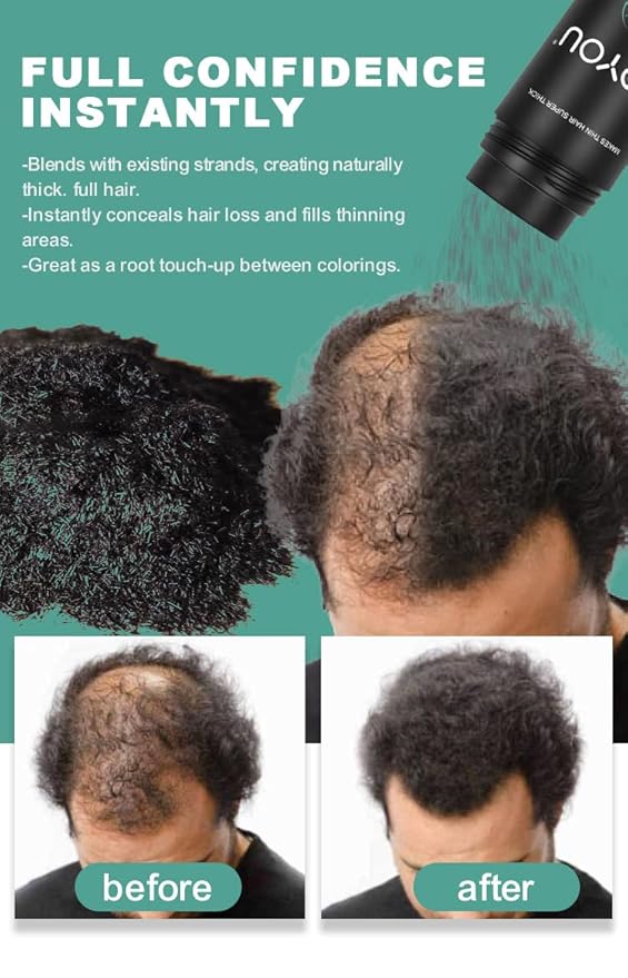 LIGHT BROWN Hair Fibers for Thinning Hair 27.5g Bottle | Undetectable & Natural Keratin Hair Fibers Concealer for Hair Loss for Men and Women | Hair Building Fibres Powder [LIGHT BROWN]