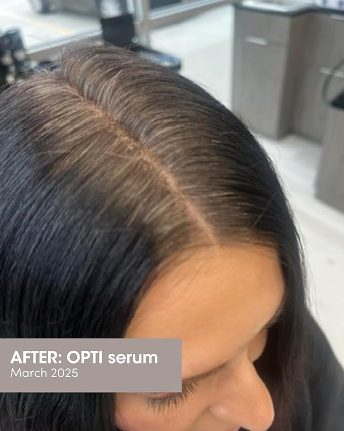 SEVEN SATARA OPTI Shampoo for Women & Men, Hair Growth & Thinning Solutions with Procapil + Capixyl, Promotes Fuller, Healthier Locks, Plant-Based Hair Shampoo for Vitality & Restoration, 7 fl oz