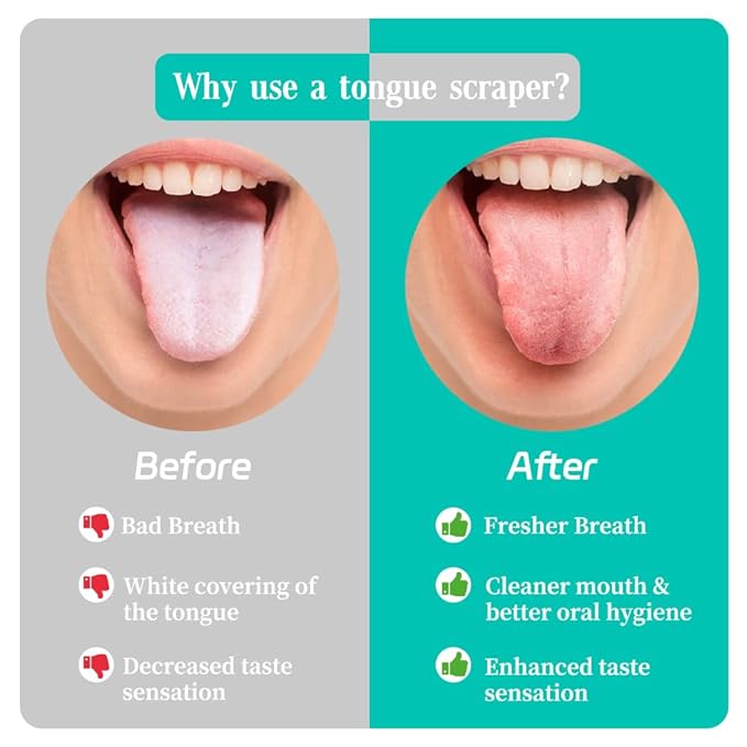 VIWIK 6 Pack Tongue Scraper for Adults, 100% Stainless Steel Tongue Cleaner - Hygienic Oral Care Tools, Bad Breath Remover Tongue Brusher
