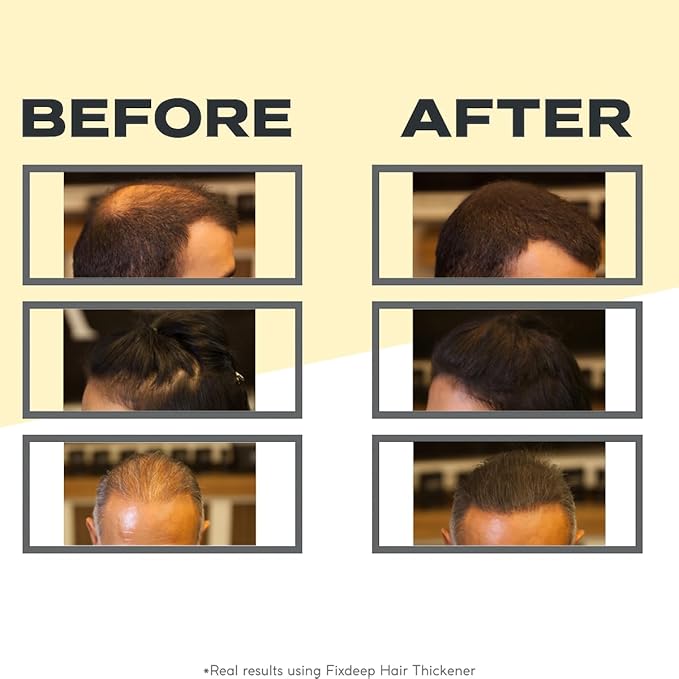 Hair Thickener | New Waterproof Formula - Natural & Fuller Appearance in 30 Seconds - 14g - Hair Fibers for Thinning Hair, Bald Spots & Graying Roots (Medium Brown)