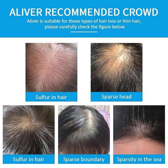 Aliver Hair Fibers for Thinning Hair - Dark Brown - Undetectable Natural Formula - Thicker Fuller Hair in 15 Seconds - Conceals Hair Loss & Look Younger - Designed for Men & Women,0.97Oz