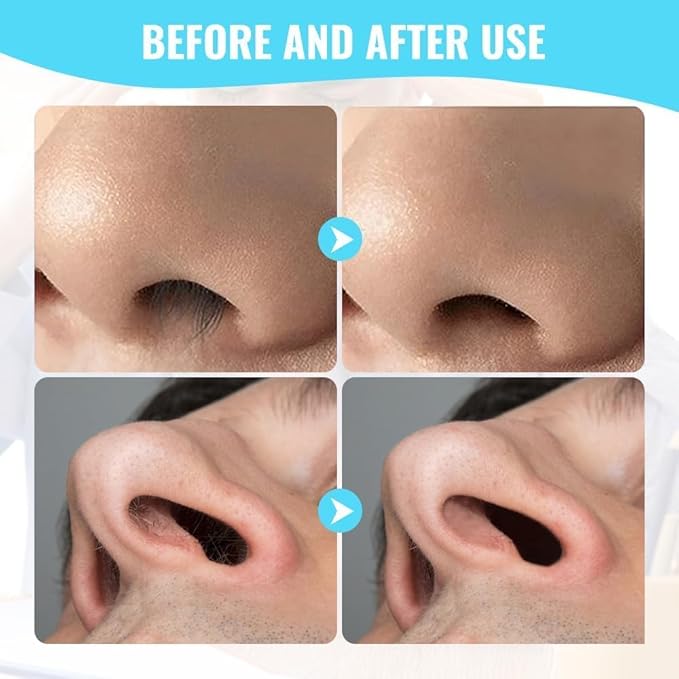 2024 New Double Sided Nose Hair Knife, 2-in-1 Nasal Cutter, Nostril Remover Tool, Portable Manual 360 Rotating Trimmer With Ear Picker for Women Men (5Pcs)