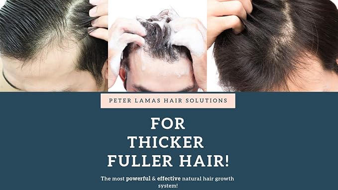Peter Lamas Biotin Shampoo for Men & Women, DHT Blocker Shampoo, Promotes Hair Growth for Thicker and Fuller Hair, Complete Dry Scalp Treatment with Peppermint Oil for Daily Hair Care
