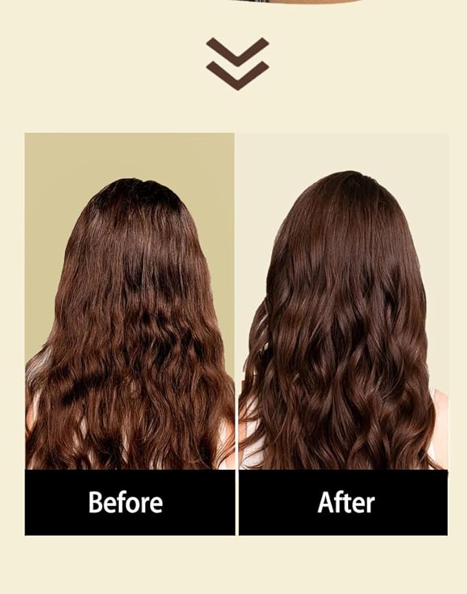 ShilkCity Professional Anti-Hair Loss Conditioner with Biotin, Keratin & Rosemary with DHT blockers to fight Hair Loss for Men & Women, All Hair types, Sulfate-Free, Vegan, pH Balanced, Organic –300ml