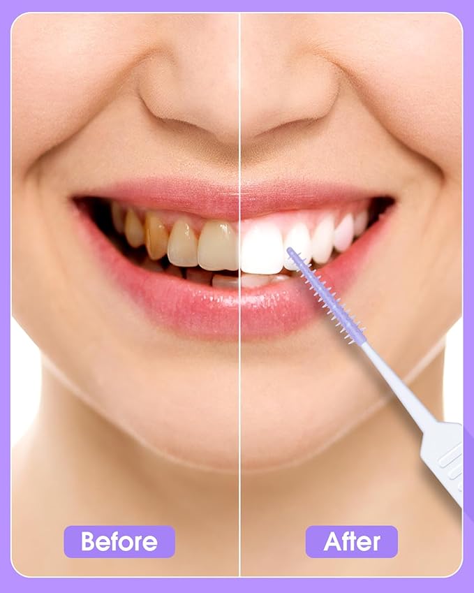 270 PCS Dental Floss Picks, Floss Picks for Teeth, Soft Silicone interdental Brush, Toothpicks Dental Brush, Tooth Flossing Picks with Case, Disposable for Teeth Cleaning, Purple Color