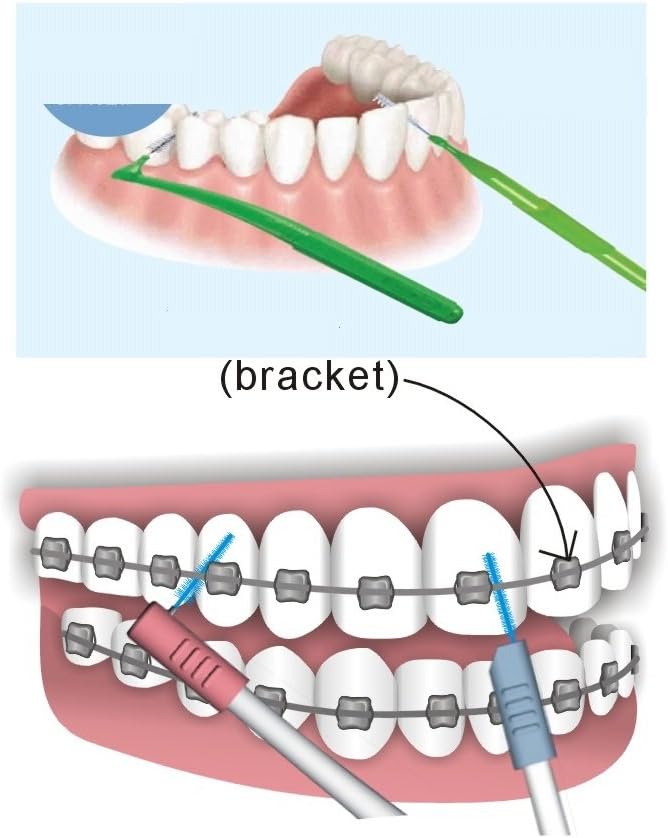 Interdental Angled Brush, Blue, 20 Each (Pack of 2) 1