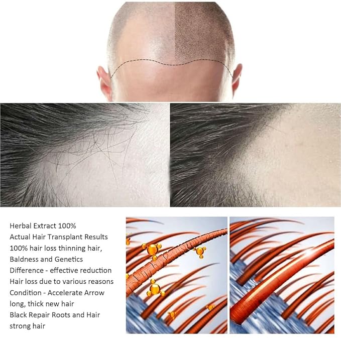 2PCS Hair Growth Spray for Anti Hair Loss Fast Treatment Scalp Prevent Hair Thinning Dry Frizzy Conditioning Strong Hair Root