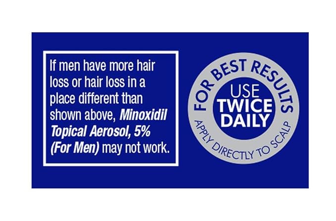Minoxidil for Men, 2.11 Oz (1 Month Supply) Clinically Proven to Regrow Hair, Topical Aerosol Foam 5%, Hair Thinning Treatment