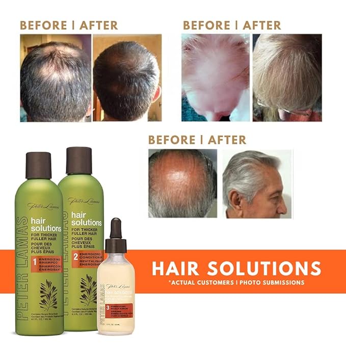 Peter Lamas Biotin Regrowth Conditioner | Apple Stem Cell, Vitamin B, Aloe, and Natural Botanicals Combine to Support Thicker, Fuller Hair | Reduce Scalp Irritation, Itching, and Flaking (Pack of 2)