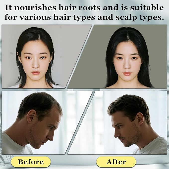 2 Pack Root Activator Shampoo for Men,Hair Growth Shampoo for Hair Loss and Thinning Hair,Thickening & Nourishing for All Hair,Natural Formula for Men and Women