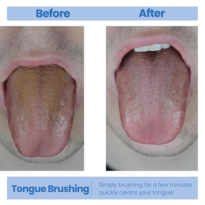 Tongue Scraper for Fresh Breath Perfect Tongue Scraper for Adults and Kids, Enhance Your Oral Hygiene with Tongue Brushes, Scrapers for Bad Breath Treatment (3 Pack (Scraper))