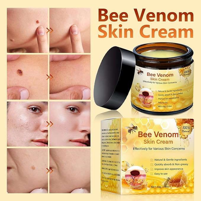 Bee Venom Comprehensive Cream - 2025 Bee Venom Skin Treatment Cream for Face and Body, Professional Natural Skin Restoration All In One Moisturizer For Women Men