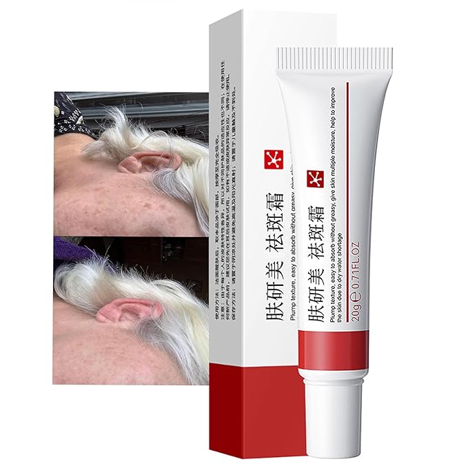 Generic Crema para Manchas Oscuras en La Cara, Dark Spot Remover for Face, Freckles Melasma Brown Spot Corrector for Men Women, Crema para Las Manchas de La Cara 20G