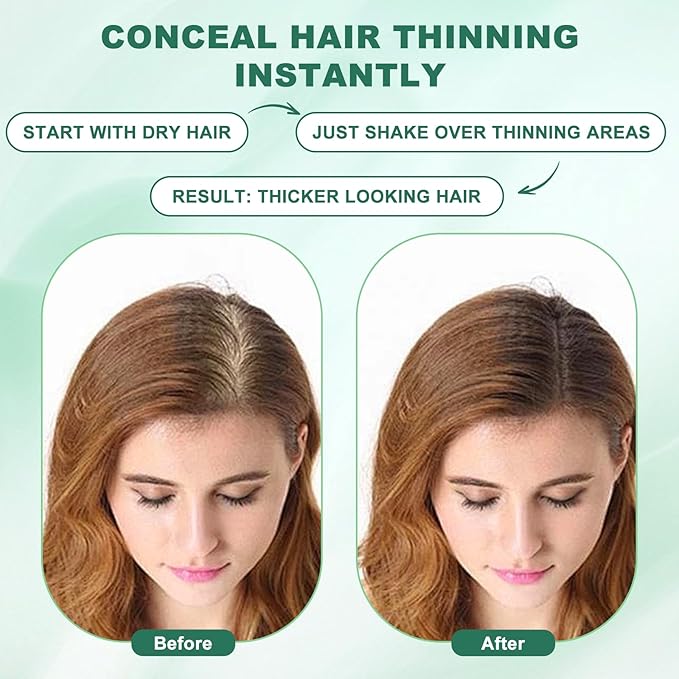 Hair Fibers (28g), Hair Fibers for Thinning Hair, Hair Building Fibers, Hairpiece Filler, Increase Hair Density, Styling Powder for Women & Men, Hair Makeup, Premium Formula Thickening (DARK BROWN)