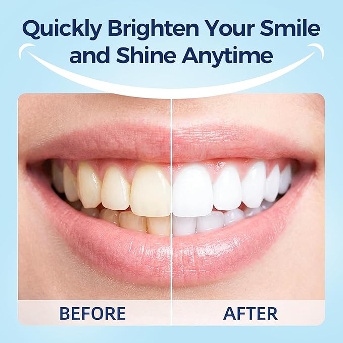 Teeth Whitening Strips - Professional Instant-Effect Edition，Whitening Strips-7-Day Care，Safe Formulas Suitable for Sensitive Teeth- Protect Enamel，Tooth Whitening Strips Kit