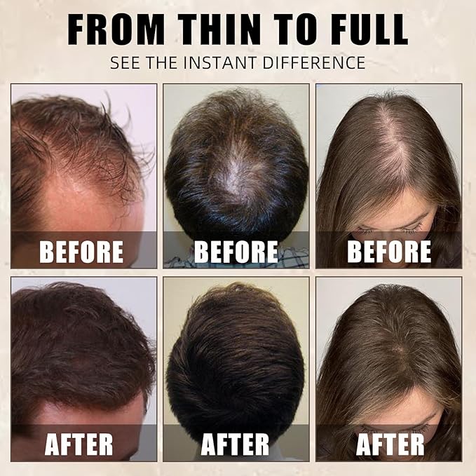 Hair Building Fibers Set, 15g x 2 Bottles with Press Applicator, Lightweight Fiber Powder for Thinning Areas, Natural Volume, Travel-Friendly Kit, Black
