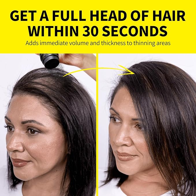 SEVICH Hair Building Fibers - Instant Hair Thickener for Thinning Hair Loss, Natural Keratin Powder for Men Women, Medium Brown 25g/0.88oz