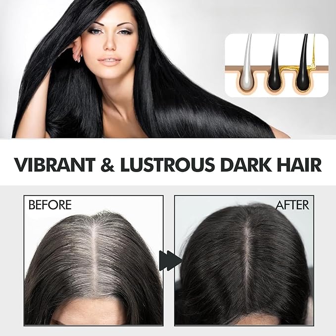 Hair Growth Spray for Thinning Hair,Hair Regrowth Treatment to Reduce Hair Loss, Thicken Hair & Boost Volume (1pcs)