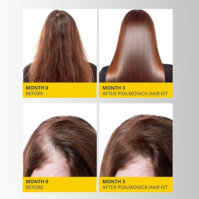 Hair Growth Shampoo and Conditioner Set: Sulfate Free Hair Growth Root Activator Thickening Shampoo for Hair Loss and Thinning Hair - Hair Loss RegrowthTreatments for Women Men