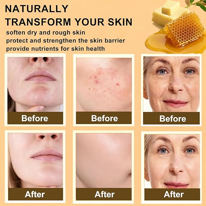 Tallow and Honey Balm - 100% Grass-Fed Beef Tallow for Skin with Organic Raw Honey - Deeply Moisturizing Beef Tallow for Face Body - Natural Formula Care for Dry & Sensitive Skin (5.3 OZ), Citrus