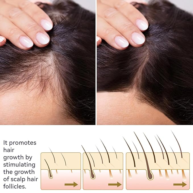 Hair Growth Spray, Natural Hair Regrowth Spray, Herbs Ginseng Hairs Tonic, Hydrating Helper for Shine & Strength, Lightweight Leave-In Oil for All Hairs Types (3 Pcs Set)
