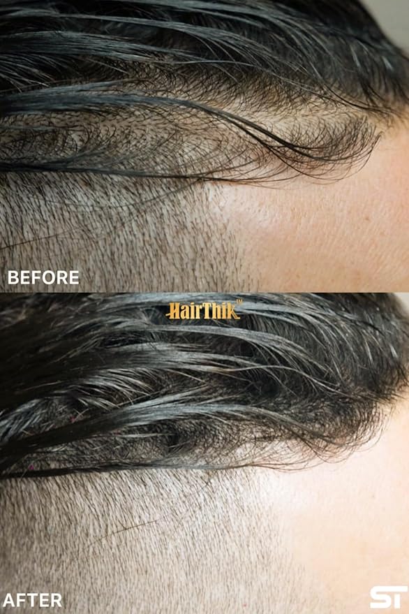Supreme Trimmer Hair Building Fibers 8-in-1 Kit | 25G Keratin Fibers, Pump Nozzle, Hairline Cards, S&L Shaker, Brush, Wipes, Mirror | Conceal & Thicken Thinning Hair in Men & Women | Dark Brown