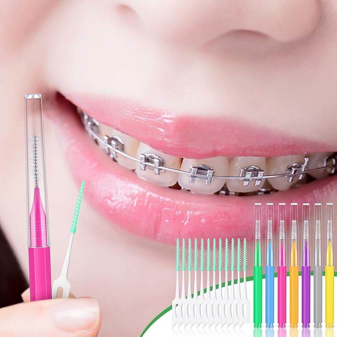 Zopeal 250 Pcs Interdental Brush for Braces Disposable Braces Flossers Dental Picks Floss Toothpick Dental Teeth Flossing Head Oral Hygiene Flosser Toothpick Soft Cleaning Tool(Lovely Color)