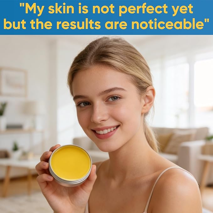 2PCS Acne & Redness Killer, Acne Set for Healthy Skin, Facial Cream With Marigold, Thistle, Lavender, Beeswax, Sea Buckthorn, Vitamin E - For All Skin Types Men & Women