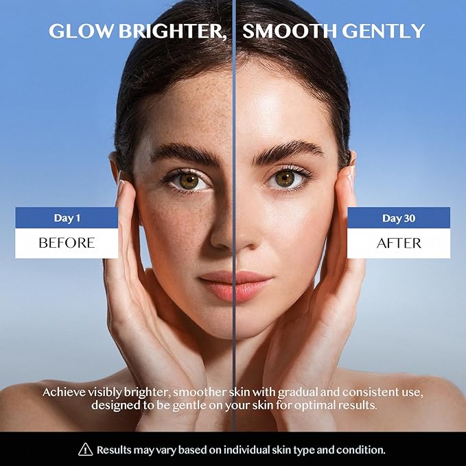 Dark Spot Remover for Face and Body: Dark Spot Remover - Melasma, Freckle, Sun Spot, Age Spot Remover Advanced Formula with Niacinamide for Women and Men(1.7 Fl Oz)