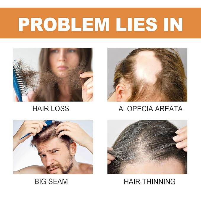 2ml Hair Growth Serum for Thinning Hair & Hair Loss - 7 Count Hair Strength Pro Ampoules with Biotin, Jojoba Oil, Rosemary & Vitamin E - Scalp Treatment to Reduce Shedding & Thicken Hair