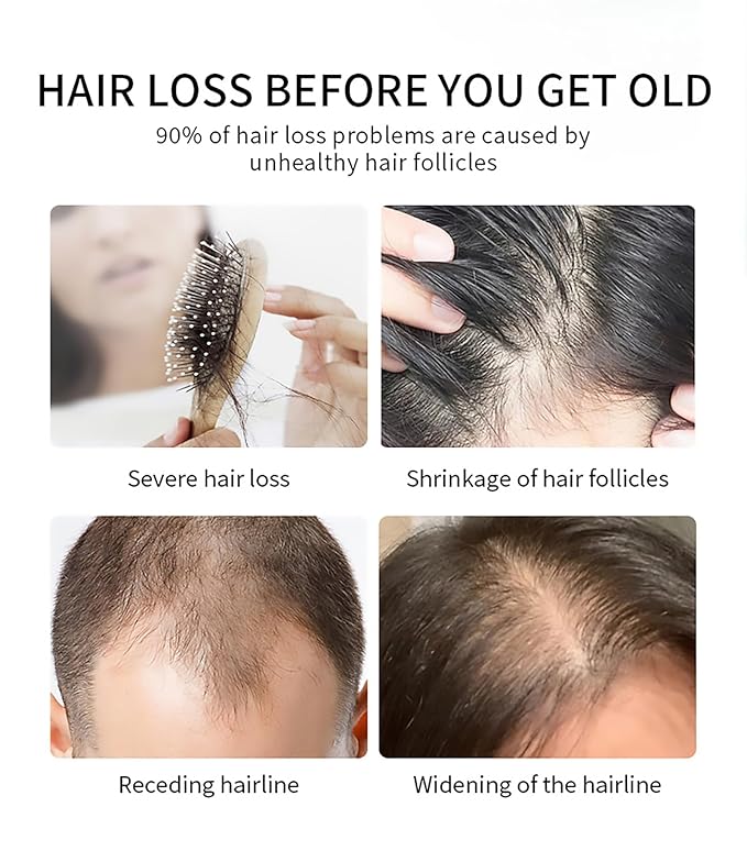 Hair Care Essence Spray with Anti-hair Loss Serum，Rich in Biotin, Oriental Leaf Extract to Nourish the Skin and Condition the Hair,Suitable for All Hair Types，2.1oz(1pcs)