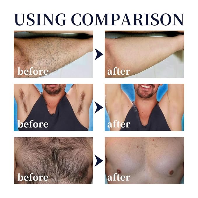Men's Hair Removal Spray Foam - Plant Extract Soothing Depilation Spray Painless & Gentle Depilatory Cream for All Skin Types - Effective for Armpits, Chest, Back, Legs & Body