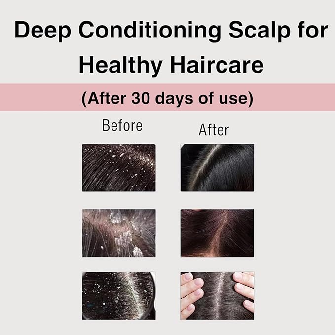 Moist Diane Keratin Shampoo and Conditioner for Women & Men, Curly Shampoo and Conditioner Set with Argan Oil, Collagen, Protein from Japan, Paraben& Sulfate Free Shampoo & Conditioner 30.4Fl Oz VITAL