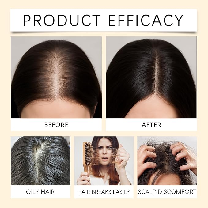 30mL Roll-On Hair Density Serum For Thinning Hair – Anti Hair Loss Treatment With Biotin & Rosemary Oil To Strengthen Roots And Revitalize Scalp